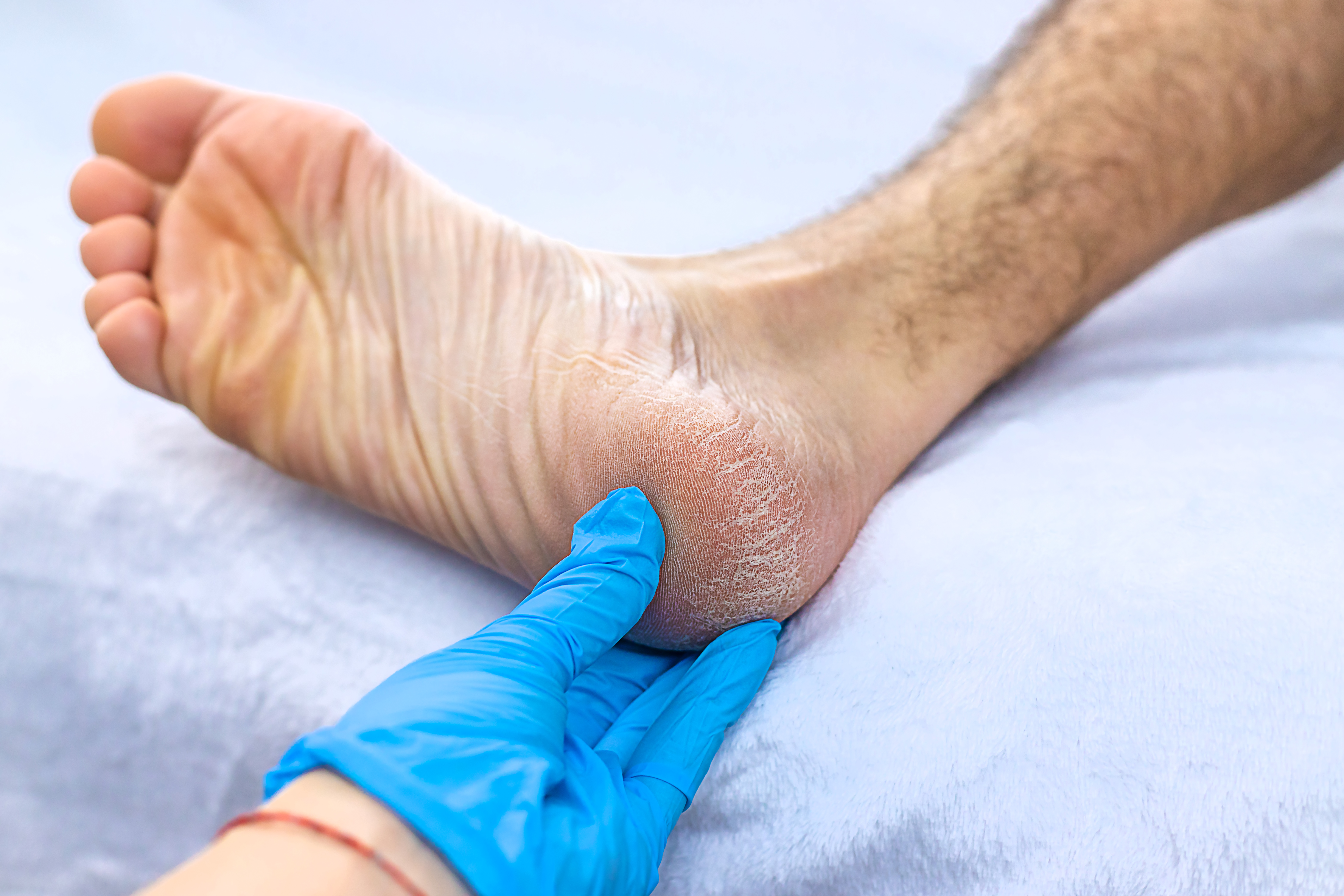 Tarsal Tunnel Syndrome: Symptoms, Causes, and Treatments