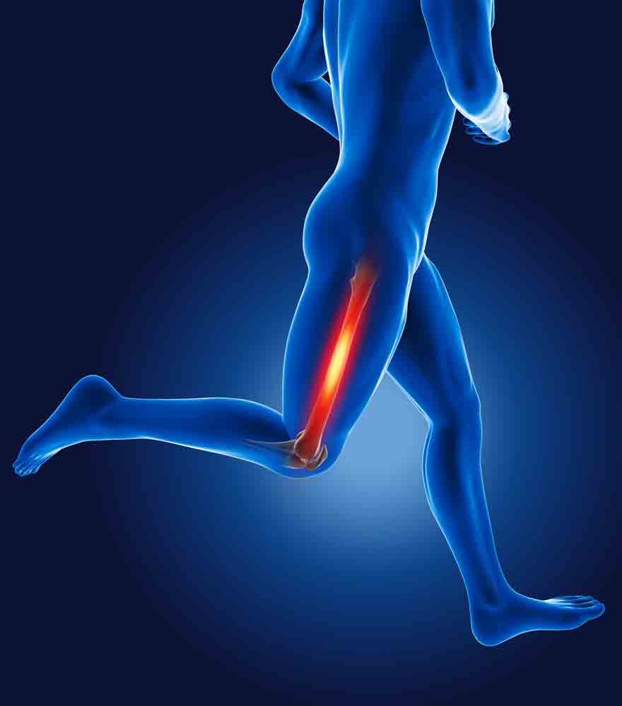 managing it band friction syndrome chronic pain