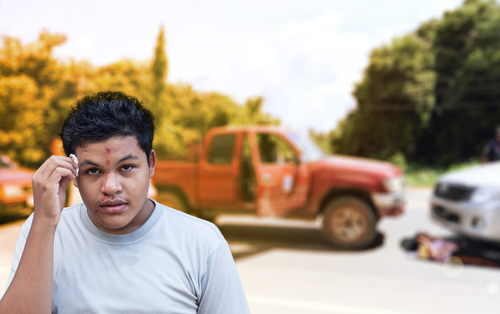 3 common car accident-related face injuries